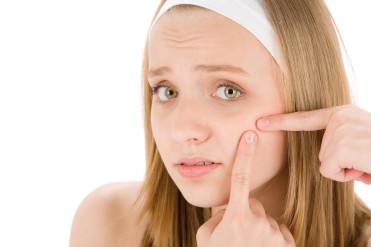 Acne facial care teenager woman squeezing pimple